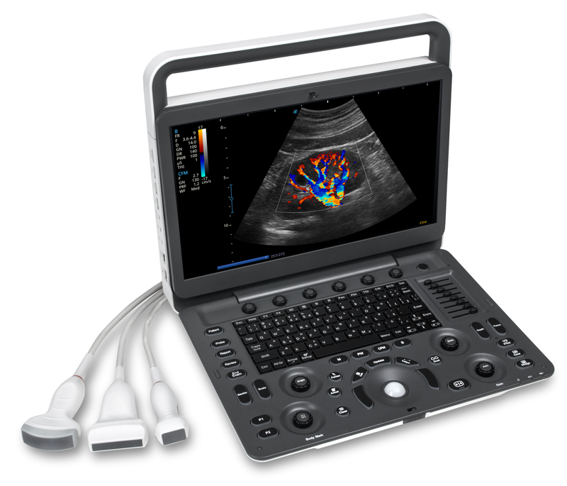 Digital Portable Ultrasound with Led Monitor