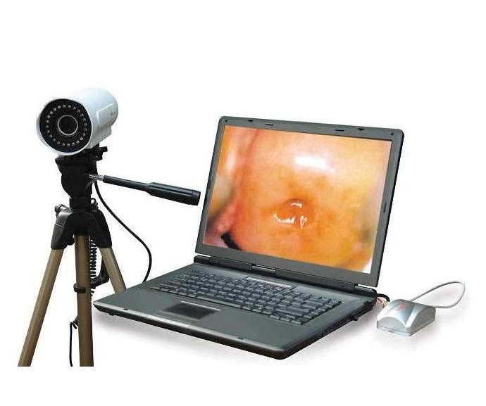 Laptop Video Colposcope